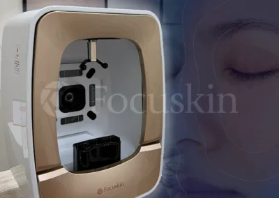 Analizador Facial FocuSkin en Griñón