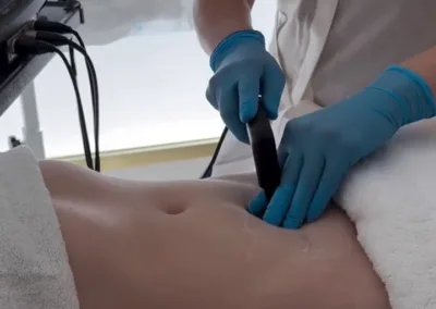 Fisioterapia del Suelo Pélvico